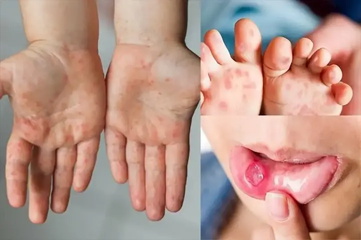 Giường Trẻ Em Tại Đà Nẵng Giường Trẻ Em Tại Đà Nẵng